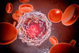 Leukemias subtle cues demand early vigilance Leukemias subtle cues demand early vigilance